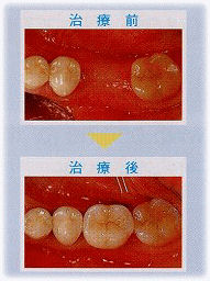 クボタ歯科醫院
SANZE インプラントセンター